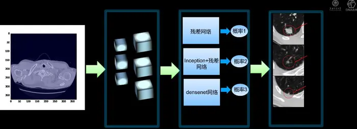 天池大数据竞赛第一名，上海交通大学人工智能实验室如何用AI定位肺结节