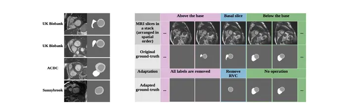 论文阅读笔记（四十九）：3D Consistent & Robust Segmentation of Cardiac Images by Deep Learning with Spatial Pr..