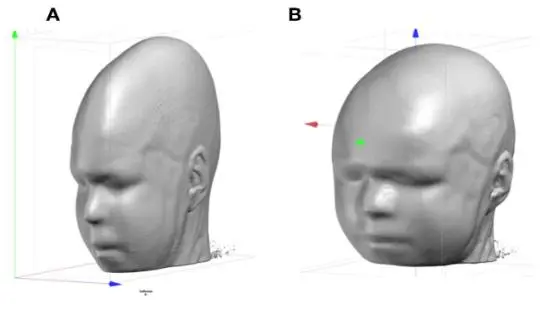 如何使用Cartool工具包分析EEG源成像？